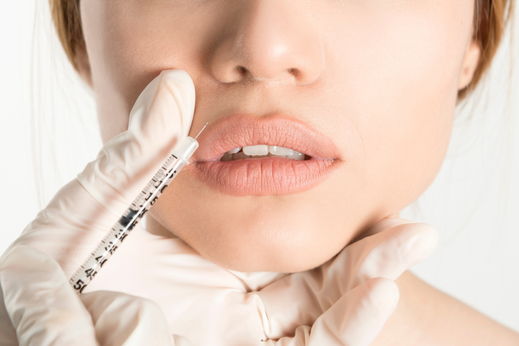 Everything you Need to Know About the Botox Lip Flip