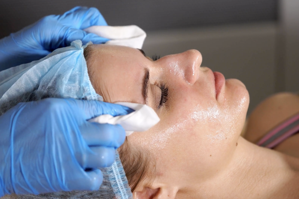 Different Types of Chemical Peels